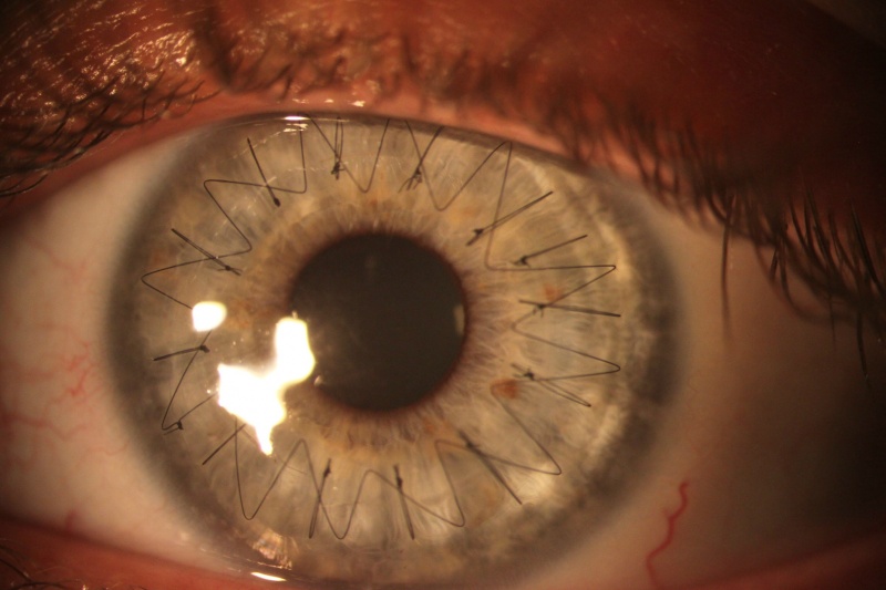 L'oeil est incroyable